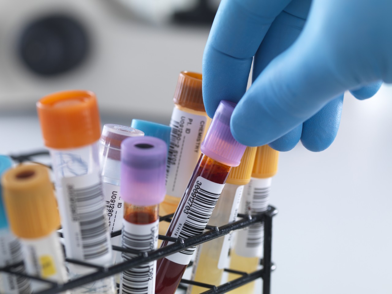 一致性评价大幕开启，医院市场即将调整