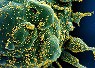 唾液检测新冠抗体新步骤来了，获取了局仅需几幼时！