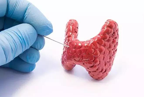 甲状腺疾病，蕴含甲状腺职能减退和甲状腺职能亢进，自古以来就是反复被医学钻研人员钻研的疾病