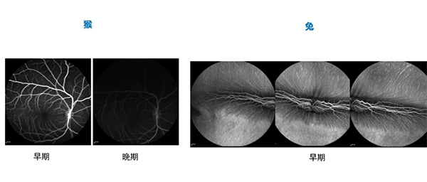 分歧时期的眼底荧光造影（FA）.jpg