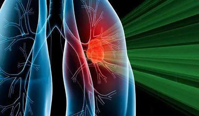 盛世泰科1类创新药物CGT-9475实现中美双报双批 | 和记H88一站式临床前生物医药研发服务平台助力