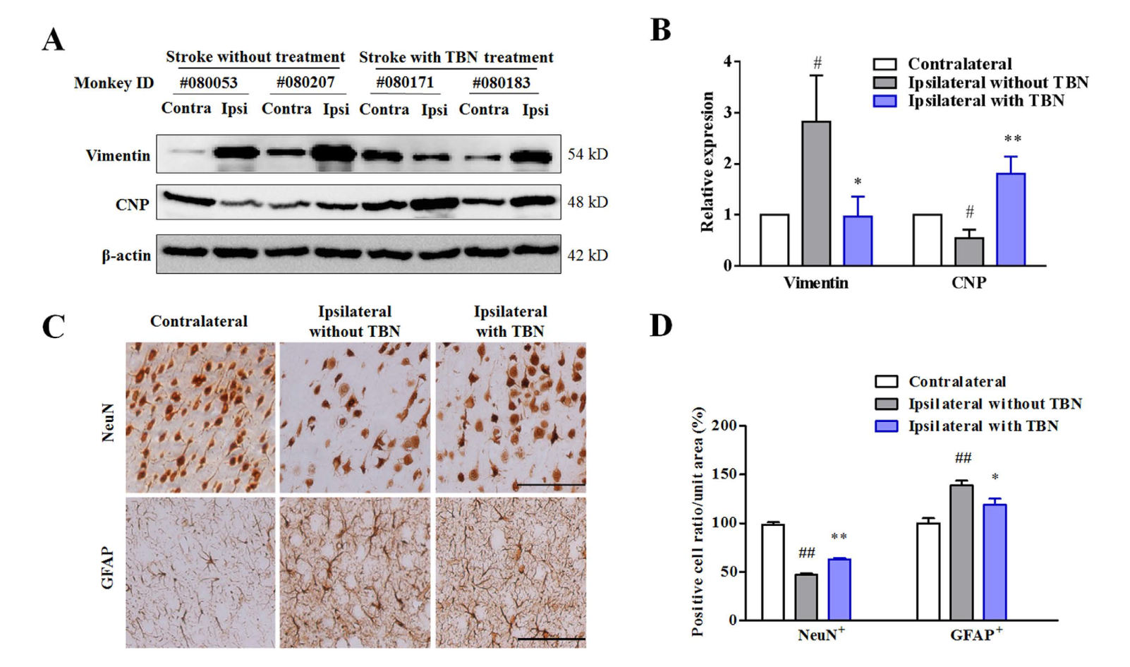 TBN是一种医治缺血性卒中的新型临床候选药物，本钻研中TBN通过和记H88合成
